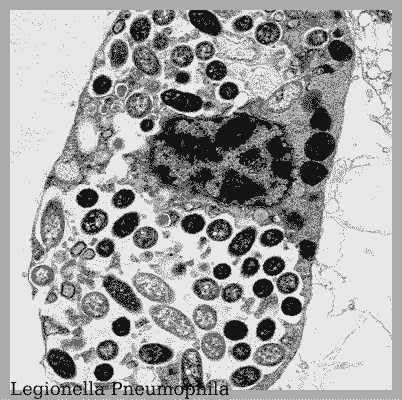 Legionella Amstelveen